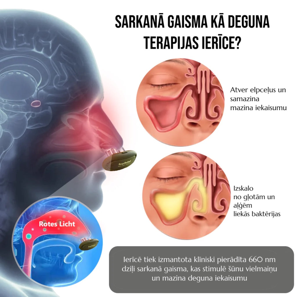 RespiRelief deguna terapijas ierīce