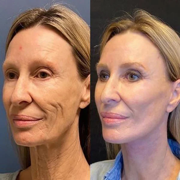 BOTOX SEJAS SERUMS